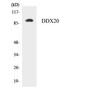 DDX20 / GEMIN3 Antibody - Western blot analysis of the lysates from K562 cells using DDX20 antibody.