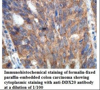DDX20 / GEMIN3 Antibody