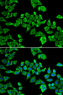 DDX20 / GEMIN3 Antibody - Immunofluorescence analysis of HeLa cells.