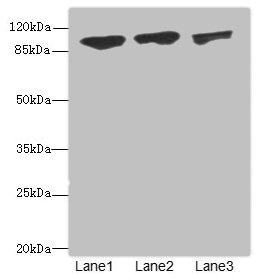 DDX20 / GEMIN3 Antibody - Western blot All Lanes: DDX20antibody at 1.91ug/ml Lane 1 : 293T whole cell lysate Lane 2 : HepG-2 whole cell lysate Lane 3 : Hela whole cell lysate Secondary Goat polyclonal to Rabbit IgG at 1/10000 dilution Predicted band size: 93,15 kDa Observed band size: 92 kDa