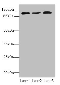 DDX20 / GEMIN3 Antibody - Western blot All Lanes: DDX20antibody at 2.05ug/ml Lane 1 : 293T whole cell lysate Lane 2 : HepG-2 whole cell lysate Lane 3 : Hela whole cell lysate Secondary Goat polyclonal to Rabbit IgG at 1/10000 dilution Predicted band size: 93,15 kDa Observed band size: 92 kDa