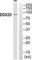 DDX20 / GEMIN3 Antibody - Western blot analysis of extracts from 293 cells, using DDX20 antibody.
