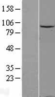 DDX20 / GEMIN3 Protein - Western validation with an anti-DDK antibody * L: Control HEK293 lysate R: Over-expression lysate