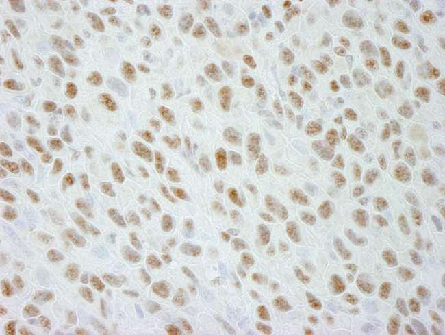 DDX21 Antibody - Detection of Mouse DDX21 by Immunohistochemistry. Sample: FFPE section of mouse squamous cell carcinoma. Antibody: Affinity purified rabbit anti-DDX21 used at a dilution of 1:250.