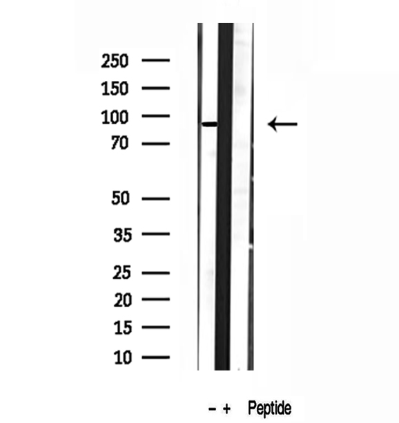 DDX21 Antibody - Western blot analysis of extracts of HepG2 cells using DDX21 antibody.