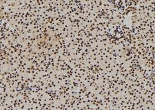 DDX21 Antibody - 1:100 staining mouse kidney tissue by IHC-P. The sample was formaldehyde fixed and a heat mediated antigen retrieval step in citrate buffer was performed. The sample was then blocked and incubated with the antibody for 1.5 hours at 22°C. An HRP conjugated goat anti-rabbit antibody was used as the secondary.