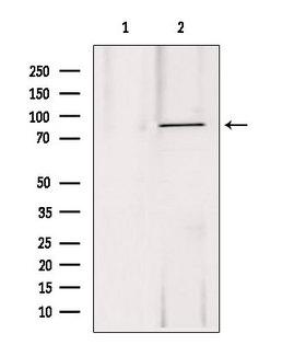DDX21 Antibody - Western blot analysis of extracts of 293 cells using DDX21 antibody. Lane 1 was treated with the blocking peptide.