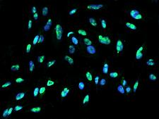 DDX21 Antibody - Immunofluorescence staining of DDX21 in U251MG cells. Cells were fixed with 4% PFA, permeabilzed with 0.1% Triton X-100 in PBS, blocked with 10% serum, and incubated with rabbit anti-Human DDX21 polyclonal antibody (dilution ratio 1:200) at 4°C overnight. Then cells were stained with the Alexa Fluor 488-conjugated Goat Anti-rabbit IgG secondary antibody (green) and counterstained with DAPI (blue). Positive staining was localized to Nucleus.