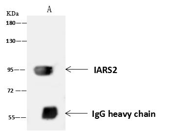 DDX21 Antibody - IARS2 was immunoprecipitated using: Lane A: 0.5 mg HepG2 Whole Cell Lysate. 4 uL anti-IARS2 rabbit polyclonal antibody and 60 ug of Immunomagnetic beads Protein A/G. Primary antibody: Anti-IARS2 rabbit polyclonal antibody, at 1:100 dilution. Secondary antibody: Goat Anti-Rabbit IgG (H+L)/HRP at 1/10000 dilution. Developed using the ECL technique. Performed under reducing conditions. Predicted band size: 87 kDa. Observed band size: 95 kDa.