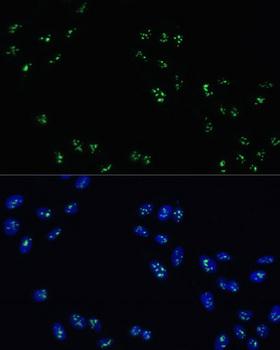 DDX21 Antibody - Immunofluorescence analysis of U-2OS cells using DDX21 Polyclonal Antibody at dilution of 1:100.Blue: DAPI for nuclear staining.