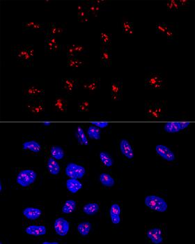 DDX21 Antibody - Confocal immunofluorescence analysis of U2OS cells using DDX21 Polyclonal Antibody at dilution of 1:100.Blue: DAPI for nuclear staining.