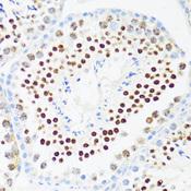 DDX21 Antibody - Immunohistochemistry of paraffin-embedded Mouse testis using DDX21 Polyclonal Antibody at dilution of 1:100 (40x lens).