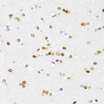 DDX21 Antibody - Immunohistochemistry of paraffin-embedded Mouse brain using DDX21 Polyclonal Antibody at dilution of 1:100 (40x lens).