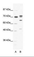 DDX21 Antibody - A: Marker, B: HepG2 Cell Lysate.  This image was taken for the unconjugated form of this product. Other forms have not been tested.
