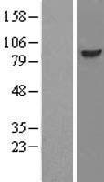 DDX21 Protein - Western validation with an anti-DDK antibody * L: Control HEK293 lysate R: Over-expression lysate