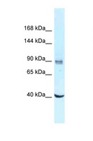 DDX23 / PRP28 Antibody - DDX23 antibody Western blot of Jurkat Cell lysate. Antibody concentration 1 ug/ml.  This image was taken for the unconjugated form of this product. Other forms have not been tested.