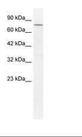 DDX23 / PRP28 Antibody - HepG2 Cell Lysate.  This image was taken for the unconjugated form of this product. Other forms have not been tested.
