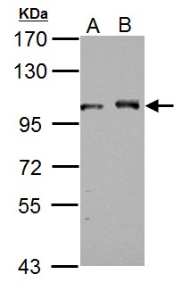 DDX23 / PRP28 Antibody - Sample (30 ug of whole cell lysate) A: NIH-3T3 B: JC 7.5% SDS PAGE DDX23 antibody diluted at 1:1000