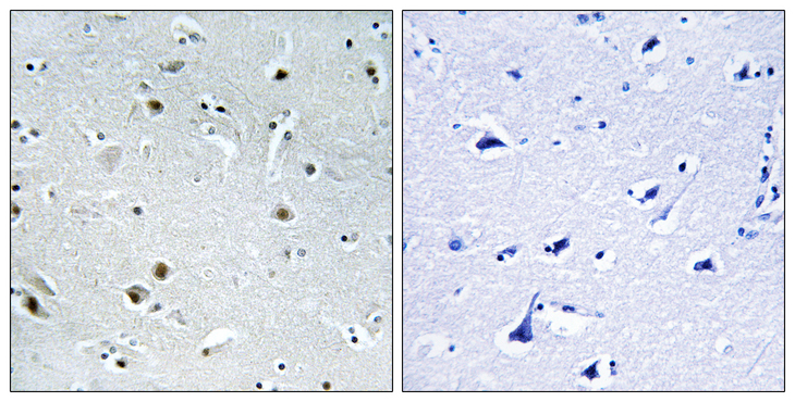 DDX24 Antibody - Immunohistochemistry analysis of paraffin-embedded human brain, using DDX24 Antibody. The picture on the right is blocked with the synthesized peptide.