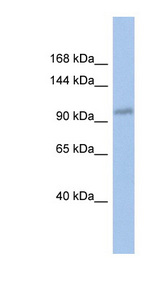 DDX24 Antibody - DDX24 antibody Western blot of OVCAR-3 cell lysate. This image was taken for the unconjugated form of this product. Other forms have not been tested.