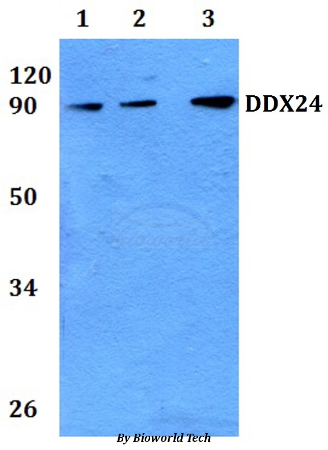 DDX24 Antibody - Western blot of DDX24 antibody at 1:500 dilution Line1:A549 whole cell lysate Line2:PC12 whole cell lysate Line3:sp20 whole cell lysate.