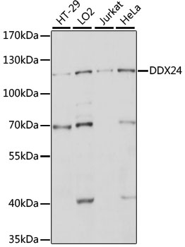DDX24 Antibody - Western blot analysis of extracts of various cell lines, using DDX24 antibody at 1:1000 dilution. The secondary antibody used was an HRP Goat Anti-Rabbit IgG (H+L) at 1:10000 dilution. Lysates were loaded 25ug per lane and 3% nonfat dry milk in TBST was used for blocking. An ECL Kit was used for detection and the exposure time was 10s.