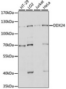 DDX24 Antibody - Western blot analysis of extracts of various cell lines, using DDX24 antibody at 1:1000 dilution. The secondary antibody used was an HRP Goat Anti-Rabbit IgG (H+L) at 1:10000 dilution. Lysates were loaded 25ug per lane and 3% nonfat dry milk in TBST was used for blocking. An ECL Kit was used for detection and the exposure time was 10s.