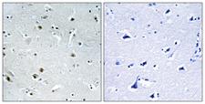 DDX24 Antibody - Peptide - + Immunohistochemistry analysis of paraffin-embedded human brain tissue using DDX24 antibody.