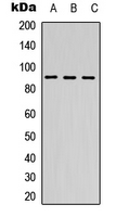 DDX24 Antibody - Western blot analysis of DDX24 expression in A549 (A); NS-1 (B); PC12 (C) whole cell lysates.