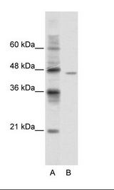 DDX25 Antibody - A: Marker, B: Jurkat Cell Lysate.  This image was taken for the unconjugated form of this product. Other forms have not been tested.