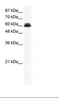 DDX27 Antibody - HepG2 Cell Lysate.  This image was taken for the unconjugated form of this product. Other forms have not been tested.