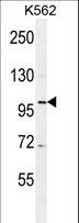 DDX27 Antibody - DDX27 Antibody western blot of K562 cell line lysates (35 ug/lane). The DDX27 antibody detected the DDX27 protein (arrow).