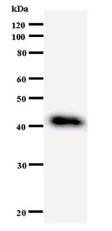 DDX27 Antibody - Western blot of immunized recombinant protein using DDX27 antibody.