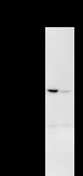 DDX27 Antibody - Detection of DDX27 by Western blot. Samples: Whole cell lysate from human HeLa (H, 25 ug) and mouse NIH3T3 (M, 25 ug) cells. Predicted molecular weight: 89 kDa