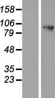 DDX27 Protein - Western validation with an anti-DDK antibody * L: Control HEK293 lysate R: Over-expression lysate