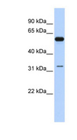 DDX28 Antibody - DDX28 antibody Western blot of Fetal Brain lysate. This image was taken for the unconjugated form of this product. Other forms have not been tested.