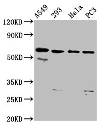 DDX28 Antibody - Positive Western Blot detected in A549 whole cell lysate, 293 whole cell lysate, Hela whole cell lysate, PC3 whole cell lysate. All lanes: DDX28 antibody at 6.1 µg/ml Secondary Goat polyclonal to rabbit IgG at 1/50000 dilution. Predicted band size: 60 KDa. Observed band size: 60 KDa