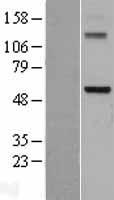 DDX28 Protein - Western validation with an anti-DDK antibody * L: Control HEK293 lysate R: Over-expression lysate