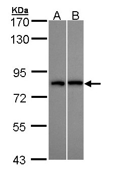DDX3 Antibody - Sample (30 ug of whole cell lysate). A: H1299, B: Hep G2 . 7.5% SDS PAGE. DDX3 antibody diluted at 1:10000