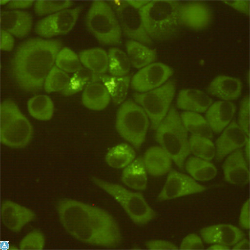 DDX3 Antibody - Immunocytochemistry staining of HeLa cells fixed with 4% Paraformaldehyde and using DDX3 mouse mAb (dilution 1:200).