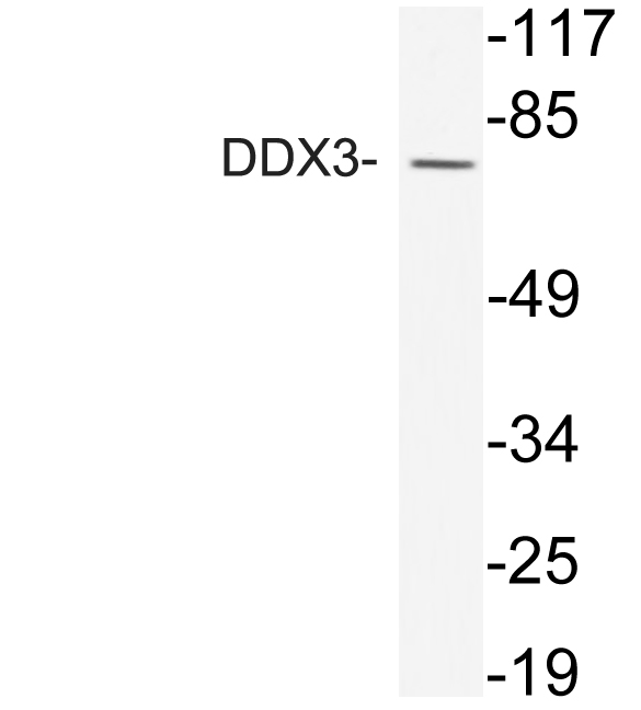 DDX3 / DDX3X Antibody - Western blot analysis of lysate from Jurkat cells, using DDX3 antibody.