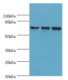 DDX3 / DDX3X Antibody - Western blot. All lanes: DDX3X antibody at 12 ug/ml. Lane 1: NIH3T3 whole cell lysate Lane 2: K562 whole cell lysate Lane 3: Jurkat whole cell lysate. Secondary antibody: goat polyclonal to rabbit at 1:10000 dilution. Predicted band size: 73 kDa. Observed band size: 73 kDa.  This image was taken for the unconjugated form of this product. Other forms have not been tested.