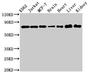 DDX3 / DDX3X Antibody - Western Blot Positive WB detected in: K562 whole cell lysate, Jurkat whole cell lysate, MCF-7 whole cell lysate, Rat brain tissue, Rat heart tissue, Mouse liver tissue, Mouse kidney tissue All lanes: DDX3X antibody at 3µg/ml Secondary Goat polyclonal to rabbit IgG at 1/50000 dilution Predicted band size: 74, 72 kDa Observed band size: 74 kDa