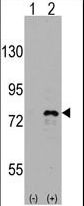 DDX3 / DDX3X Antibody - Western blot of DDX3 (arrow) using rabbit polyclonal DDX3 Antibody. 293 cell lysates (2 ug/lane) either nontransfected (Lane 1) or transiently transfected with the DDX3 gene (Lane 2) (Origene Technologies).