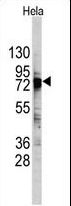 DDX3 / DDX3X Antibody - Western blot of DDX3 Antibody in HeLa cell line lysates (35 ug/lane). DDX3 (arrow) was detected using the purified antibody.