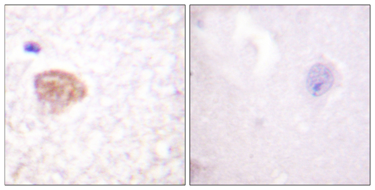 DDX3 / DDX3X Antibody - Immunohistochemistry analysis of paraffin-embedded human brain tissue, using DDX3/DEAD-box Protein 3 Antibody. The picture on the right is blocked with the synthesized peptide.