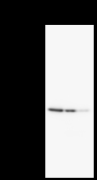 DDX3 / DDX3X Antibody - Detection of DDX3X by Western blot. Samples: Whole cell lysate from human HeLa (H, 25 ug) , mouse NIH3T3 (M, 50 ug) and rat F2408 (R, 50 ug) cells. Predicted molecular weight: 73 kDa