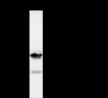 DDX3 / DDX3X Antibody - Immunoprecipitation: RIPA lysate of HeLa cells was incubated with anti-DDX3X mAb. Predicted molecular weight: 73 kDa