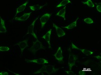 DDX3 / DDX3X Antibody - Immunostaining analysis in HeLa cells. HeLa cells were fixed with 4% paraformaldehyde and permeabilized with 0.1% Triton X-100 in PBS. The cells were immunostained with anti-DDX3X mAb.