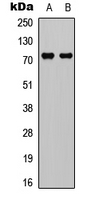 DDX3 / DDX3X Antibody - Western blot analysis of DDX3X expression in HepG2 (A); HeLa (B) whole cell lysates.